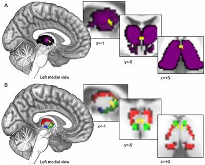 Functional Connectivity of the Human Paraventricular Thalamic Nucleus: Insights From High Field Functional MRI